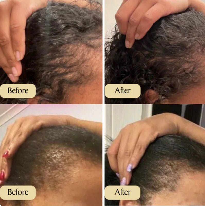 Hair Growth Oil - Pumi J Wellness Co